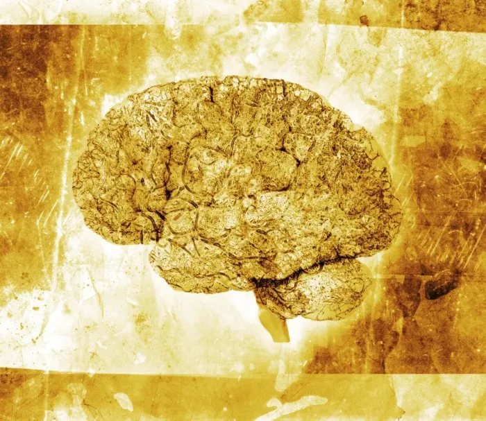 Framed Print : Aged Brain Print Framed Print : Aged Brain Print