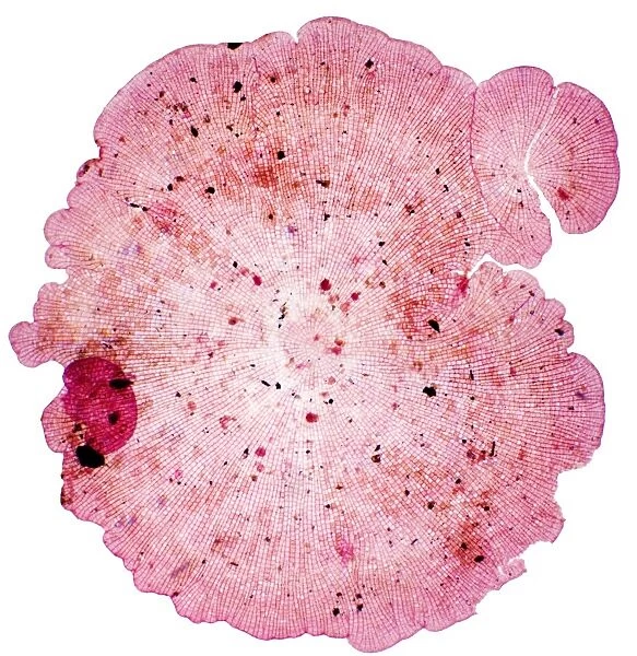 Algal colony, light micrograph