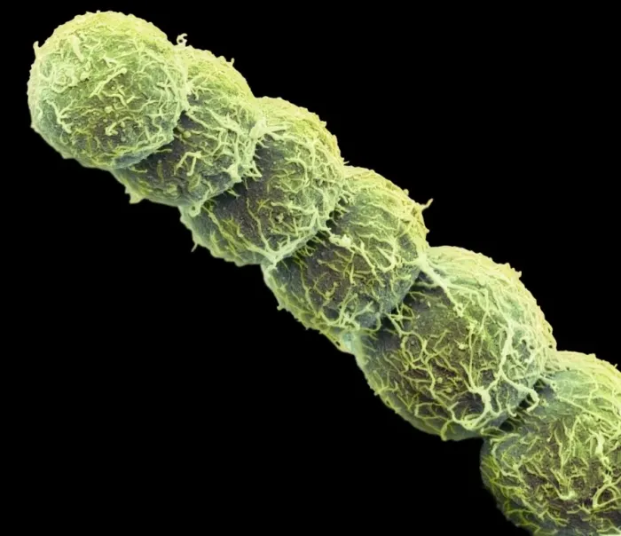 Framed Print : SEM Print of Anabaena Algae Filaments Framed Print : SEM Print of Anabaena Algae Filaments