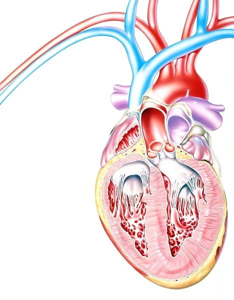 Artwork of heart in congestive heart failure