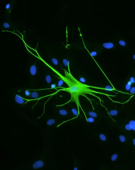 Framed Print : Astrocyte Nerve Cell Print Framed Print : Astrocyte Nerve Cell Print