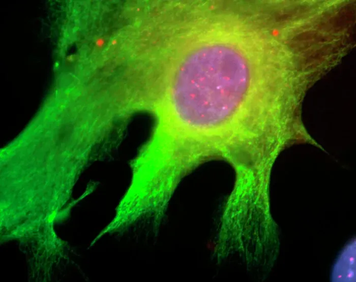 Framed Print : Astrocyte Nerve Cell Print - Fluorescent Micrograph Framed Print : Astrocyte Nerve Cell Print - Fluorescent Micrograph