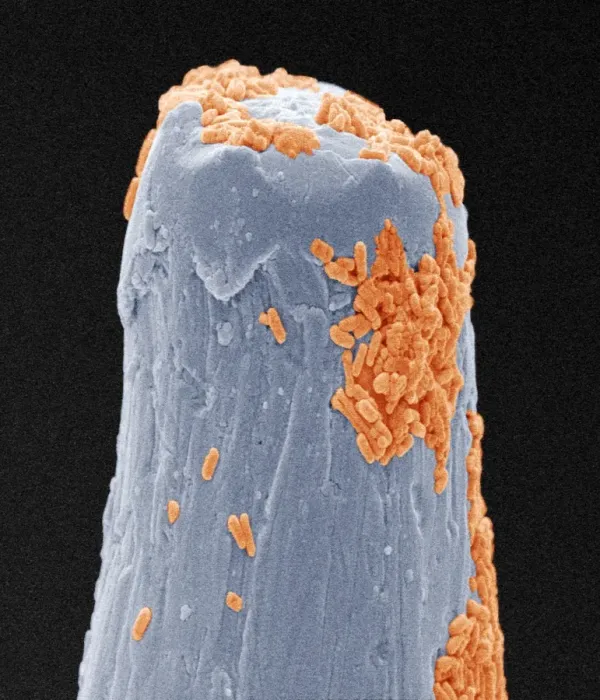 Framed Print : SEM print of bacteria on a pin, coloured scanning electron micrograph Framed Print : SEM print of bacteria on a pin, coloured scanning electron micrograph