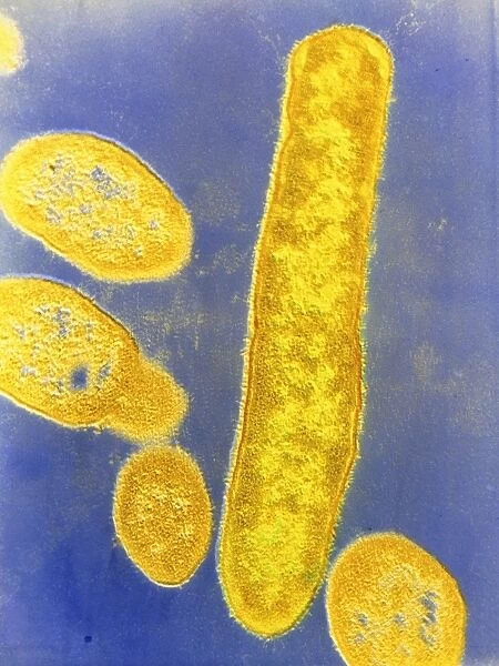 Bacteroides fragilis bacteria