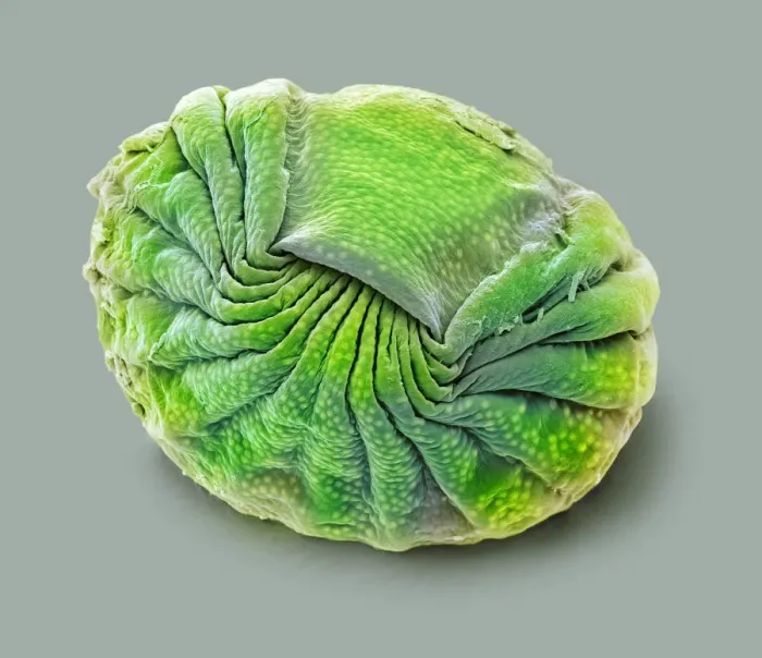 Framed Print : Bdelloid Rotifer Print, SEM Image Framed Print : Bdelloid Rotifer Print, SEM Image