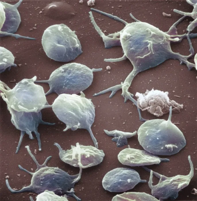 Framed Print : Activated Blood Platelets SEM Print Framed Print : Activated Blood Platelets SEM Print