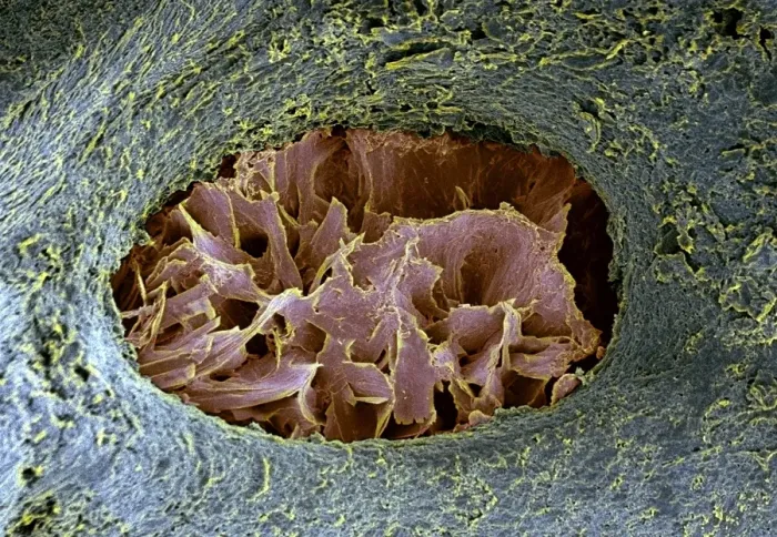Framed Print : Bone lacuna Print, SEM Coloured Image Framed Print : Bone lacuna Print, SEM Coloured Image