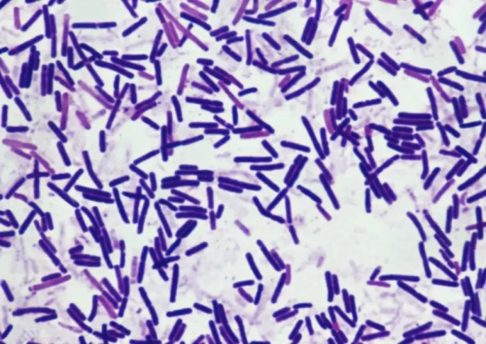 Framed Print : Botulism Bacteria Print - Light Micrograph of Clostridium botulinum Framed Print : Botulism Bacteria Print - Light Micrograph of Clostridium botulinum