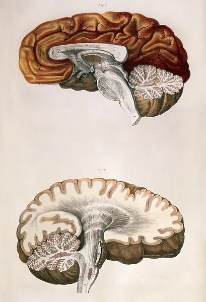 Brain, historical artwork. The top drawing shows the brain cut in-between its hemispheres