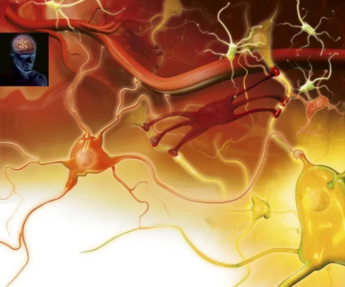 Framed Print : Brain Nerve Cells Print - Grey Matter Composition Framed Print : Brain Nerve Cells Print - Grey Matter Composition