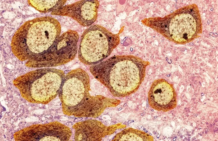 Framed Print : Brain Nerve Cells Print, TEM Micrograph Framed Print : Brain Nerve Cells Print, TEM Micrograph