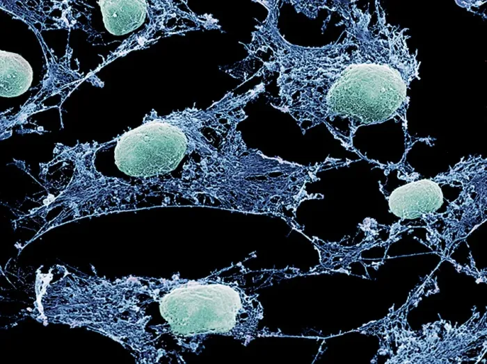 Framed Print : Cultured Cells SEM Print Framed Print : Cultured Cells SEM Print