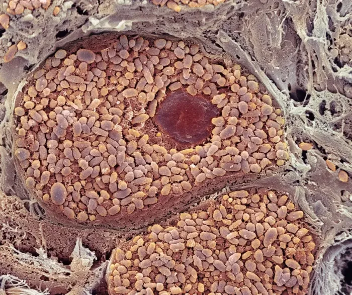 Framed Print : SEM Print of Choroid Layer Framed Print : SEM Print of Choroid Layer