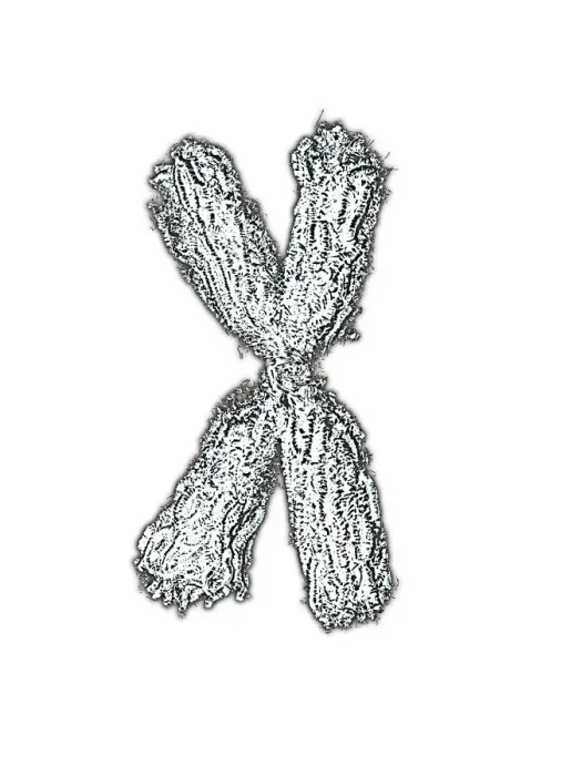 Framed Print : Condensed Chromosome Print Framed Print : Condensed Chromosome Print