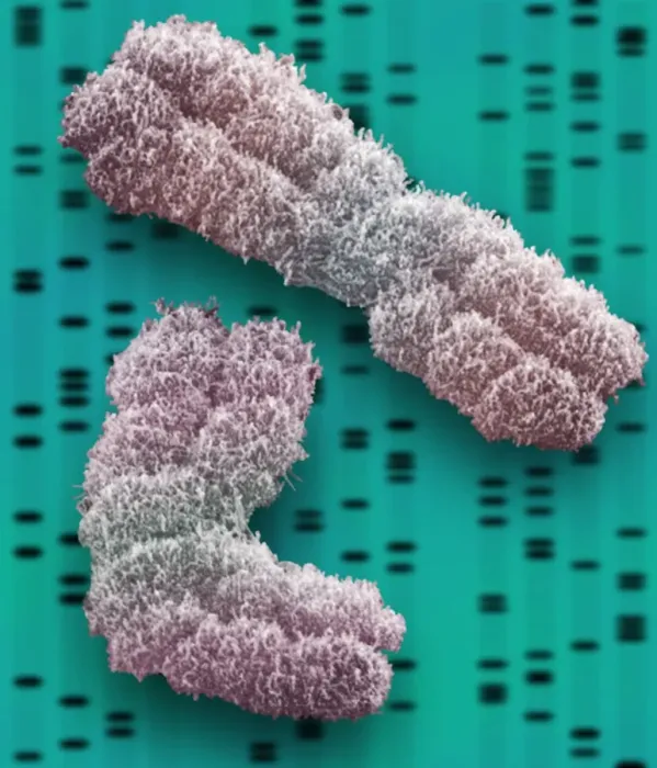 Framed Print : SEM Chromosomes Print Framed Print : SEM Chromosomes Print