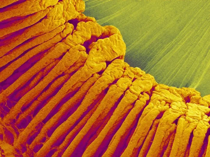 Framed Print : Ciliary Body SEM Print Framed Print : Ciliary Body SEM Print