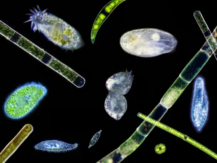 Framed Print : Ciliate Protozoa Print Framed Print : Ciliate Protozoa Print