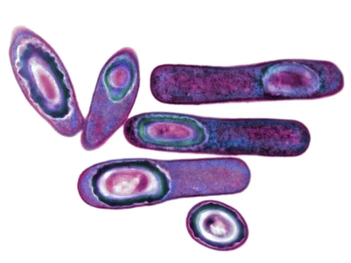 Framed Print : TEM Clostridium difficile print, 10cm wide Framed Print : TEM Clostridium difficile print, 10cm wide