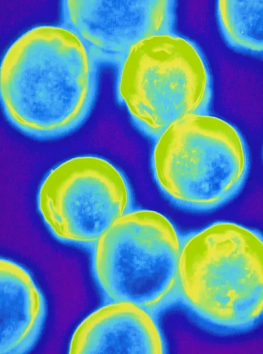 Framed Print : Coloured Light Micrograph Print of Halococcus Bacteria Framed Print : Coloured Light Micrograph Print of Halococcus Bacteria