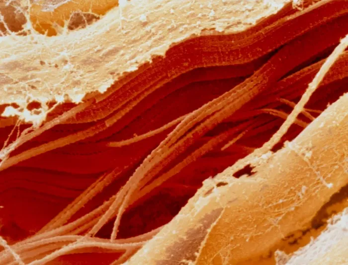 Framed Print : Coloured SEM Print of Raw Meat Section Framed Print : Coloured SEM Print of Raw Meat Section