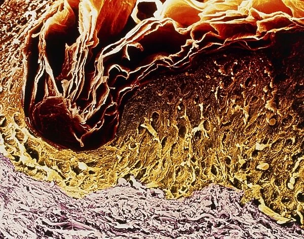 Coloured SEM of a section through skin