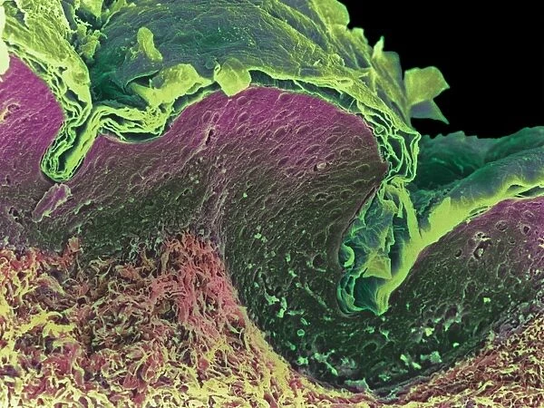 Coloured SEM of a section through skin layers