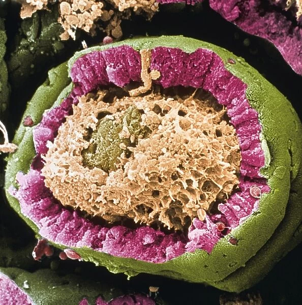 Coloured SEM of a sectioned villus from the ileum