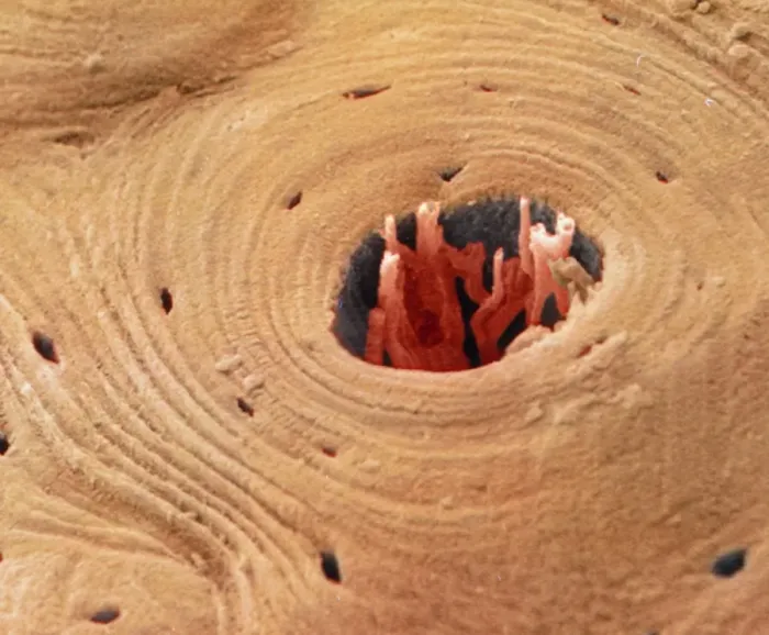 Framed Print : Coloured SEM Print of Compact Bone Transverse Section Framed Print : Coloured SEM Print of Compact Bone Transverse Section