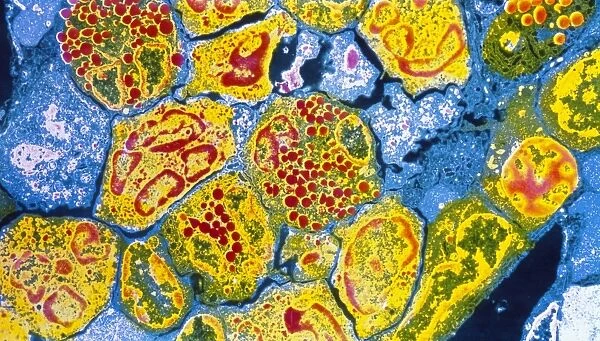 Coloured TEM of cells in bone marrow