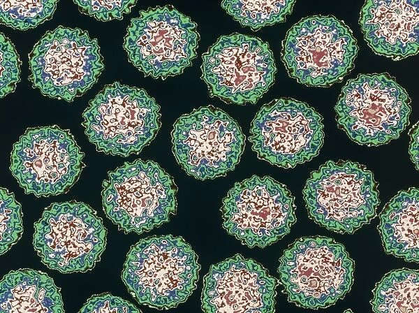 Coloured TEM of Nudaurelia beta viruses