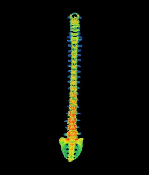 Coloured X-ray of a healthy human spine Our beautiful Wall Art and ...