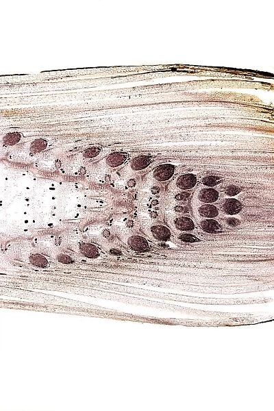 Common horsetail stem, light micrograph