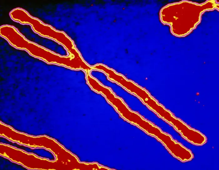 Framed Print : Computer-enhanced LM of human chromosomes Print Framed Print : Computer-enhanced LM of human chromosomes Print