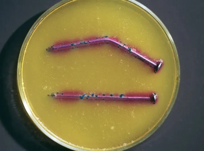 Framed Print : Corrosion Test Print - Nails in Agar Solution Framed Print : Corrosion Test Print - Nails in Agar Solution