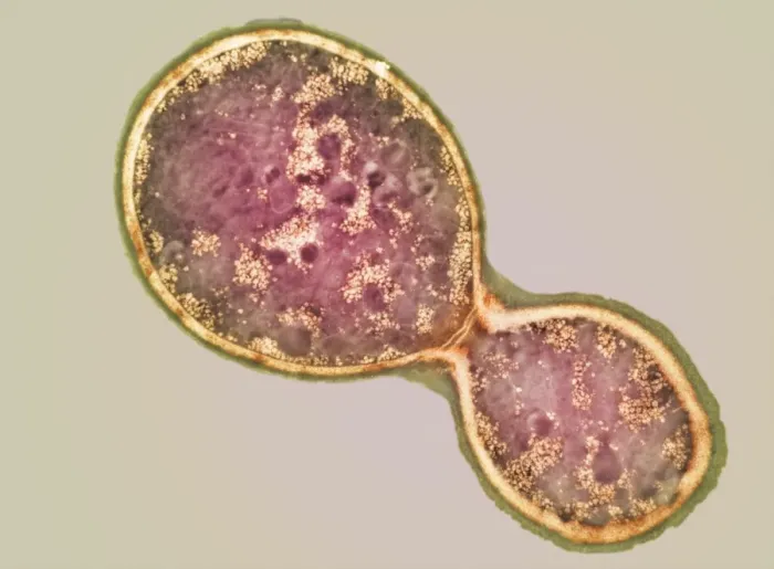 Framed Print : TEM Print of Cryptococcus Cell Dividing by Asexual Budding Framed Print : TEM Print of Cryptococcus Cell Dividing by Asexual Budding