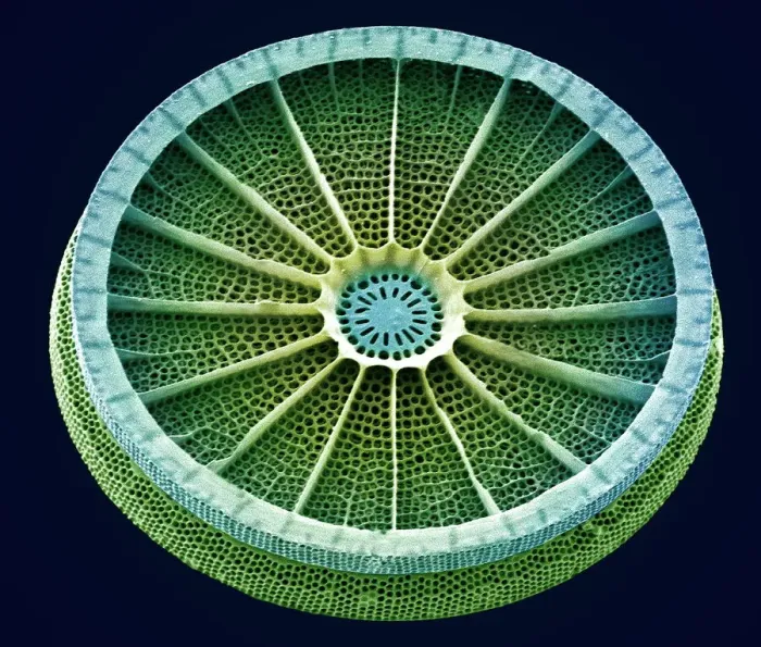 Framed Print : SEM Diatom Print: Arachnoidiscus sp. at x250 magnification, 10 cm wide Framed Print : SEM Diatom Print: Arachnoidiscus sp. at x250 magnification, 10 cm wide