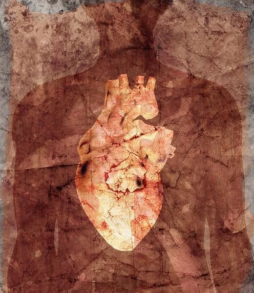 Diseased heart