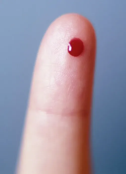 Framed Print : Blood Drop on Finger Print