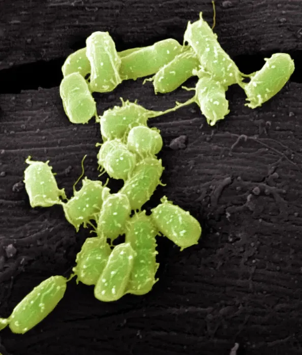 Framed Print : SEM Print of E. coli Bacteria at 10,000x Magnification Framed Print : SEM Print of E. coli Bacteria at 10,000x Magnification