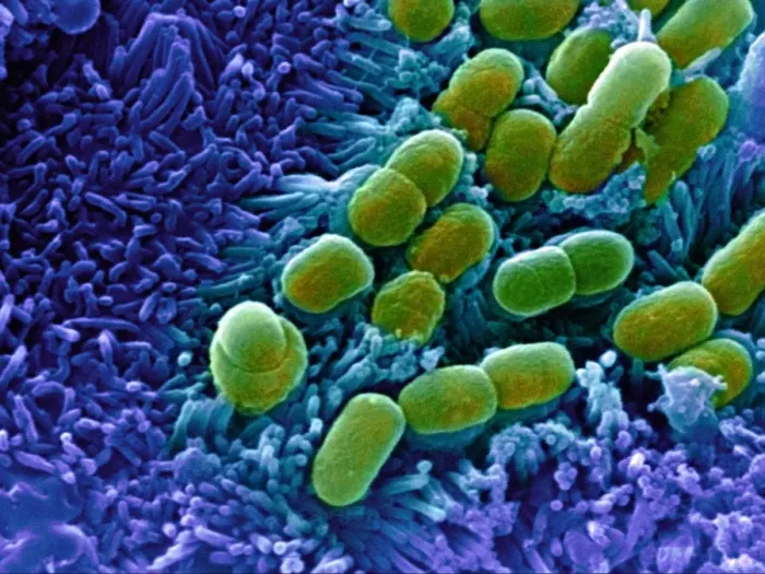 Framed Print : Print of E. coli bacteria, SEM image at 11,000x magnification Framed Print : Print of E. coli bacteria, SEM image at 11,000x magnification