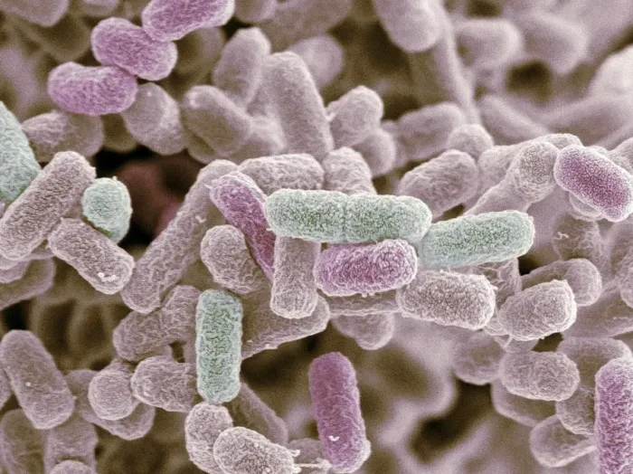 Framed Print : SEM Print of E. coli Bacteria Framed Print : SEM Print of E. coli Bacteria
