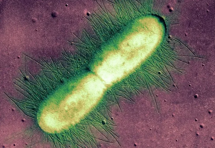 Framed Print : TEM E. coli bacterium Print, x25,000 magnification Framed Print : TEM E. coli bacterium Print, x25,000 magnification