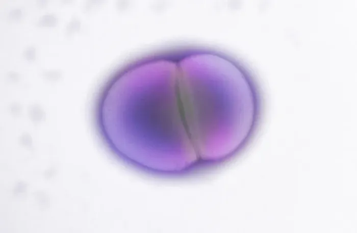 Framed Print : TEM Print of Enterococcus faecalis Dividing Cells Framed Print : TEM Print of Enterococcus faecalis Dividing Cells