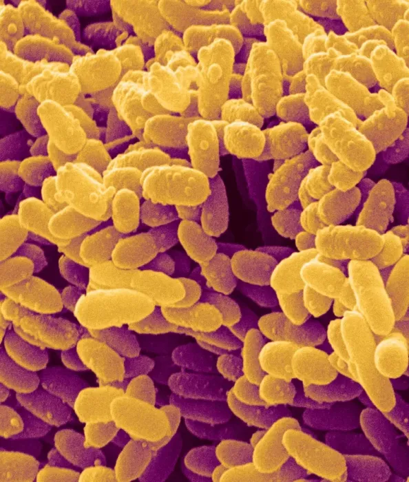 Framed Print : SEM Print of Erwinia bacteria Framed Print : SEM Print of Erwinia bacteria