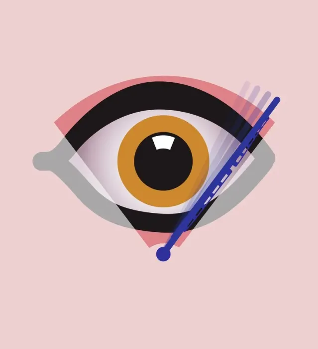 Framed Print : Eye Surgery Print Framed Print : Eye Surgery Print
