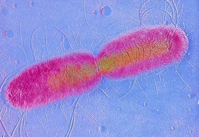 Framed Print : False-colour TEM Print of E. coli Dividing Bacteria Framed Print : False-colour TEM Print of E. coli Dividing Bacteria