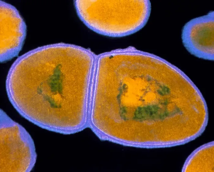 Framed Print : Enterococcus faecalis TEM Print Framed Print : Enterococcus faecalis TEM Print