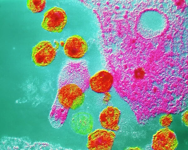 False-col TEM of AIDS virus inside T-cell