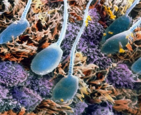 False-colour SEM of human sperm in the uterus