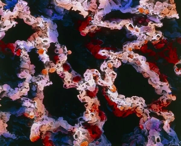 False-colour SEM of a section of lung tissue
